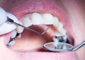 Amalgam Güvenli İse Diş Hekimim Bunu Kullanmak İçin Neden Önlem Alıyor?